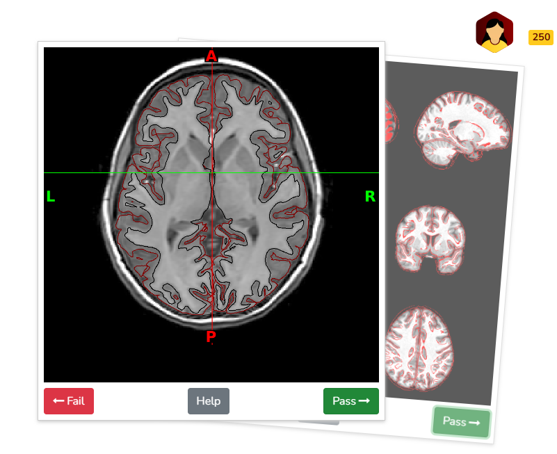 Example quality assessment of surface delineation in BrainSwipes